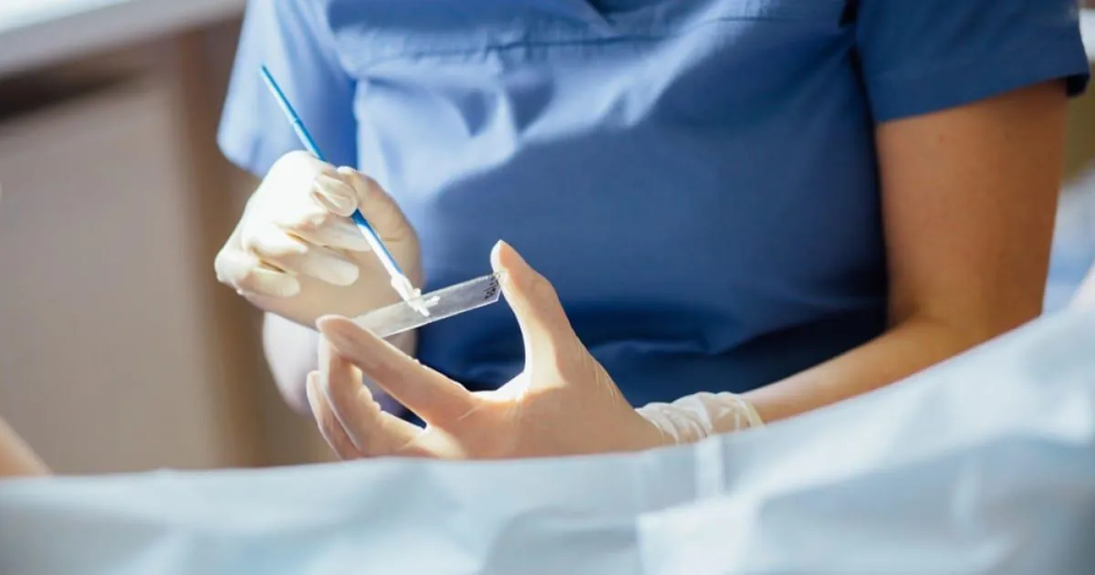 Coleta de preventivo será feita também aos sábados em Herval d’Oeste