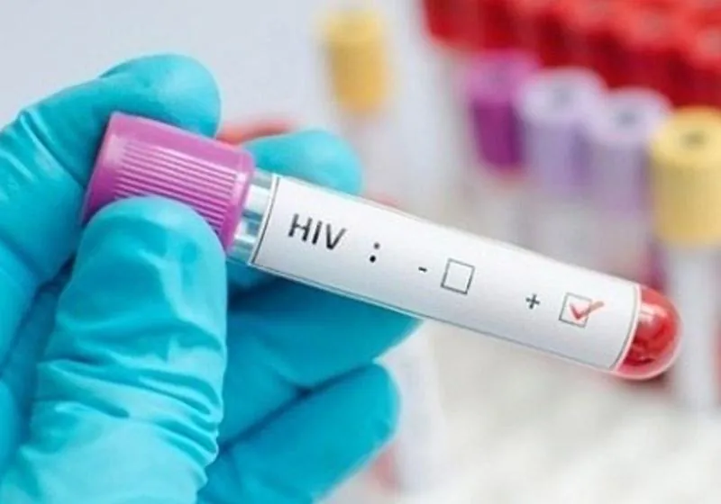 Homem acusa mulher de passar HIV intencionalmente