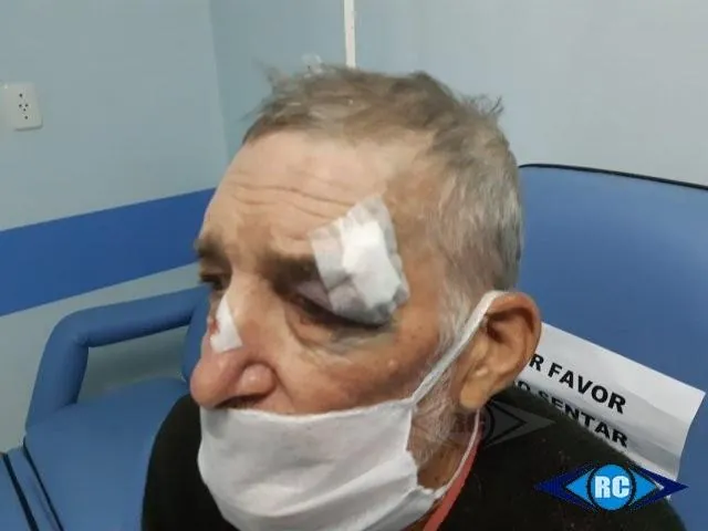 Idoso de 71 anos é agredido durante tentativa de assalto no interior de Ouro