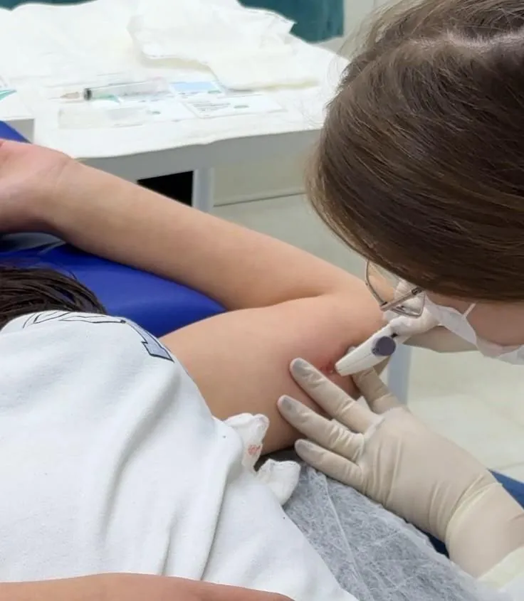 Saúde de Joaçaba amplia acesso à contracepção com disponibilização do Implanon pelo SUS