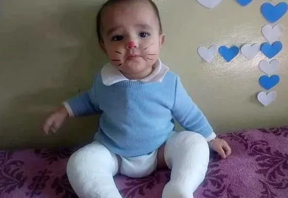 Bebê hervalense precisa de cirurgia para corrigir os pezinhos