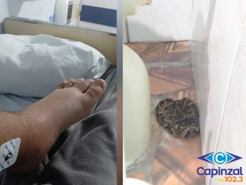 Jovem de 17 anos é picado por jararaca dentro de casa em Capinzal